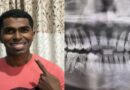 42 दांतों वाली मुस्कान ने बनाया वर्ल्ड रिकॉर्ड! इस शख्स के मुंह में सामान्य से 10 ज्यादा दांत, गिनीज में दर्ज हुआ नाम